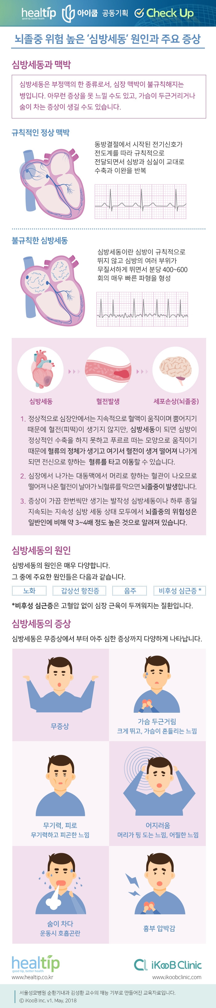 체크업28_뇌졸중 위험 높은 ‘심방세동’ 원인과 주요 증상.jpg