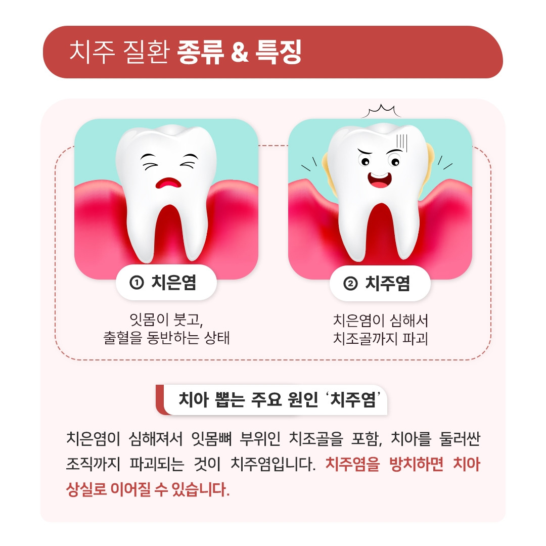 치은염&치주염_03.jpg