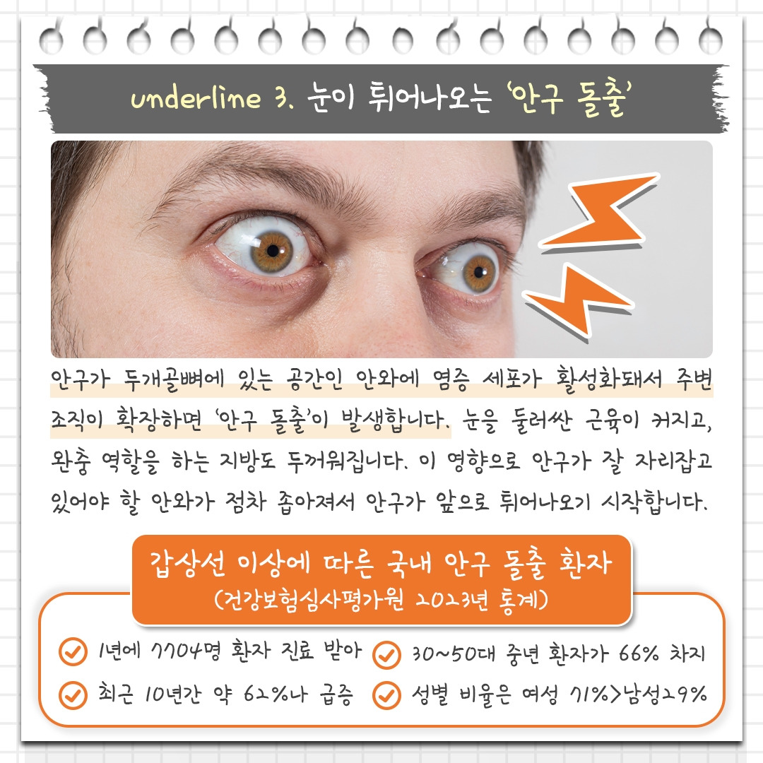 갑상선 눈질환_06 .jpg