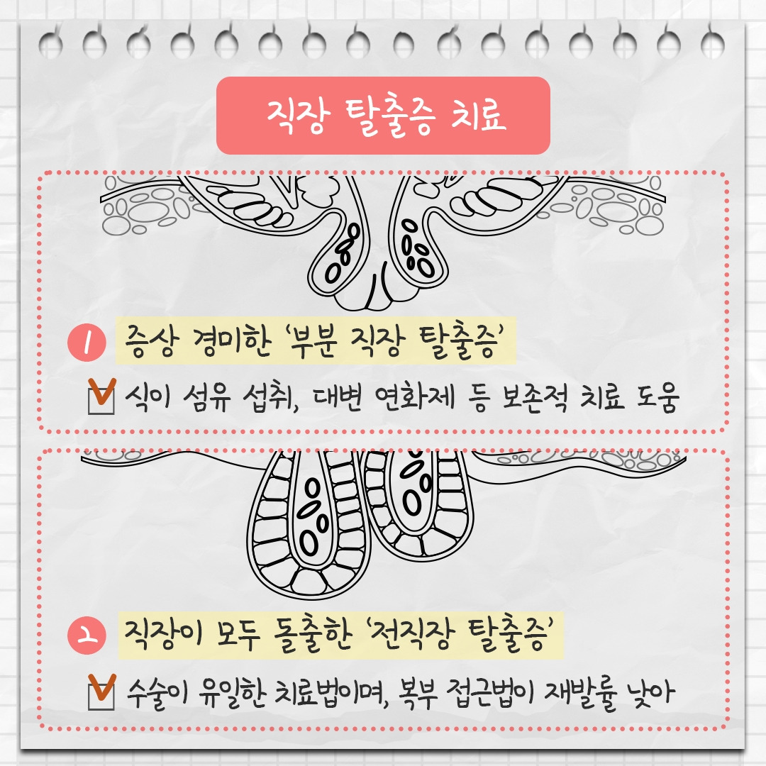 직장 탈출증 7 .jpg