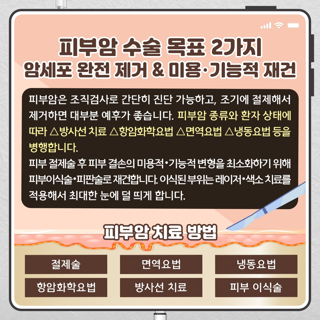 피부암_09 .jpg