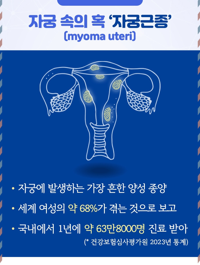 자궁근종_02.jpg