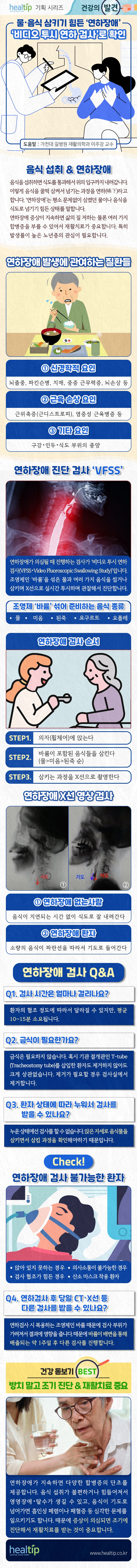 240129_연하장애 검사_힐팁.jpg