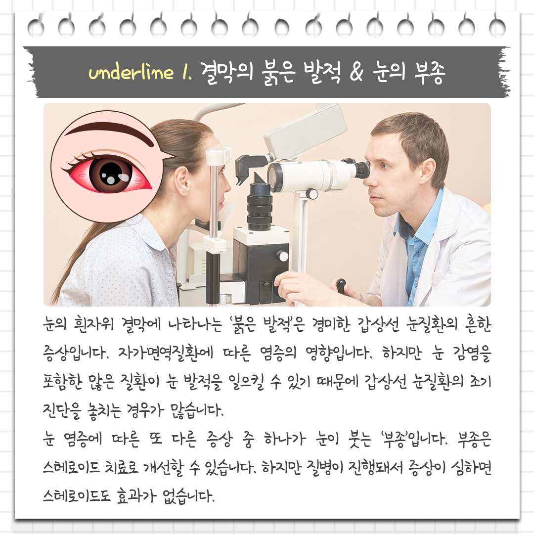 갑상선 눈질환_04 .jpg