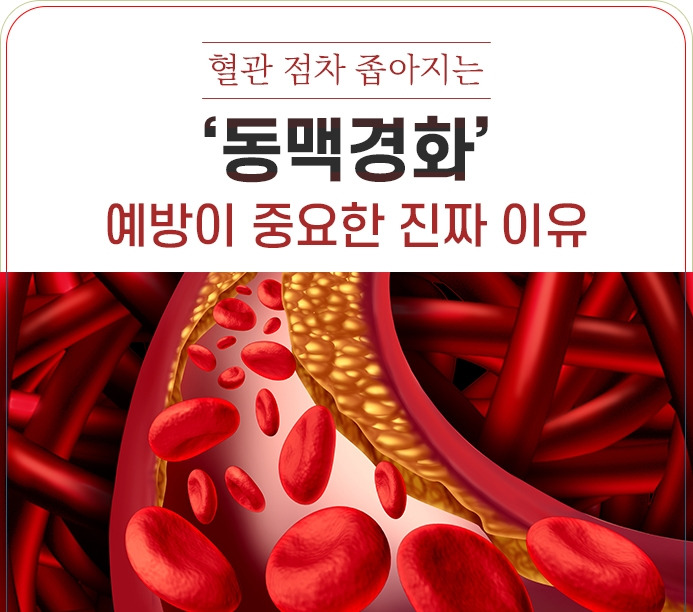 강동경희대병원363-동맥경화 예방법1.jpg