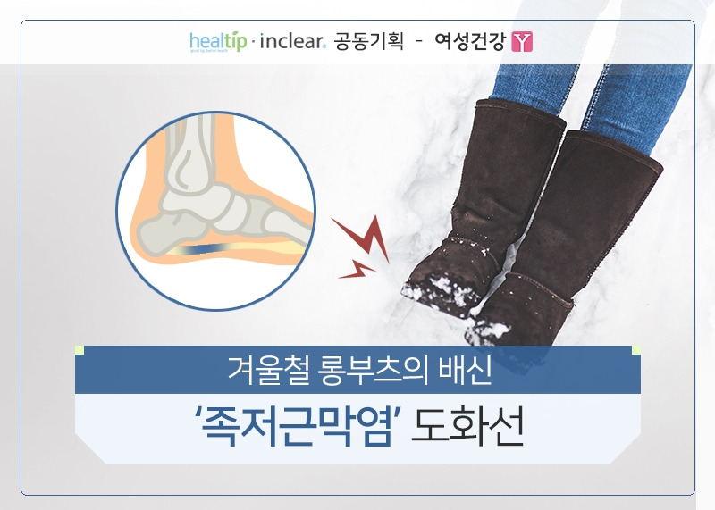 1.겨울철 롱부츠의 배신 ‘족저근막염’ 도화선.jpg