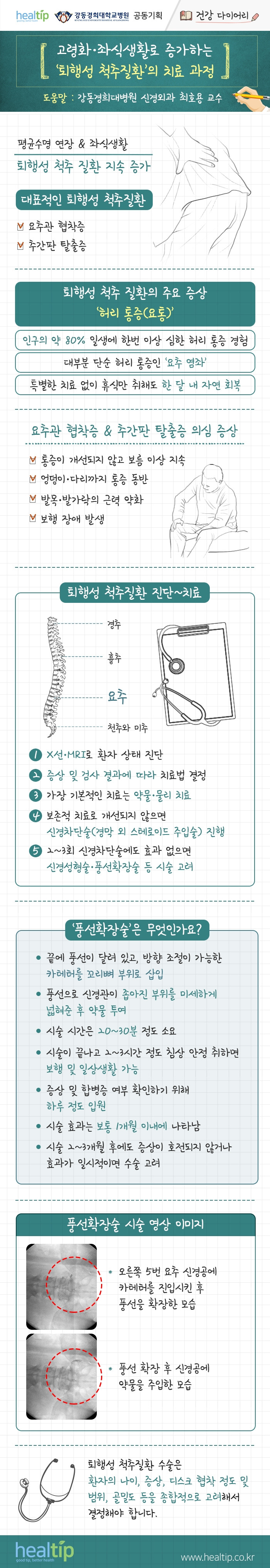 강동경희대병원404-요추관협착증 추간판 탈출증(건강 다이어리)_힐팁.jpg