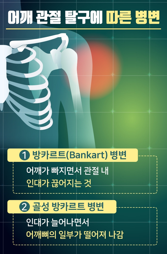 어깨관절탈구_04 .jpg