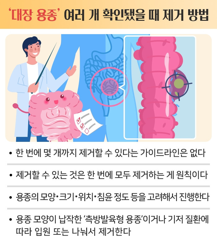 대장암_09 .jpg