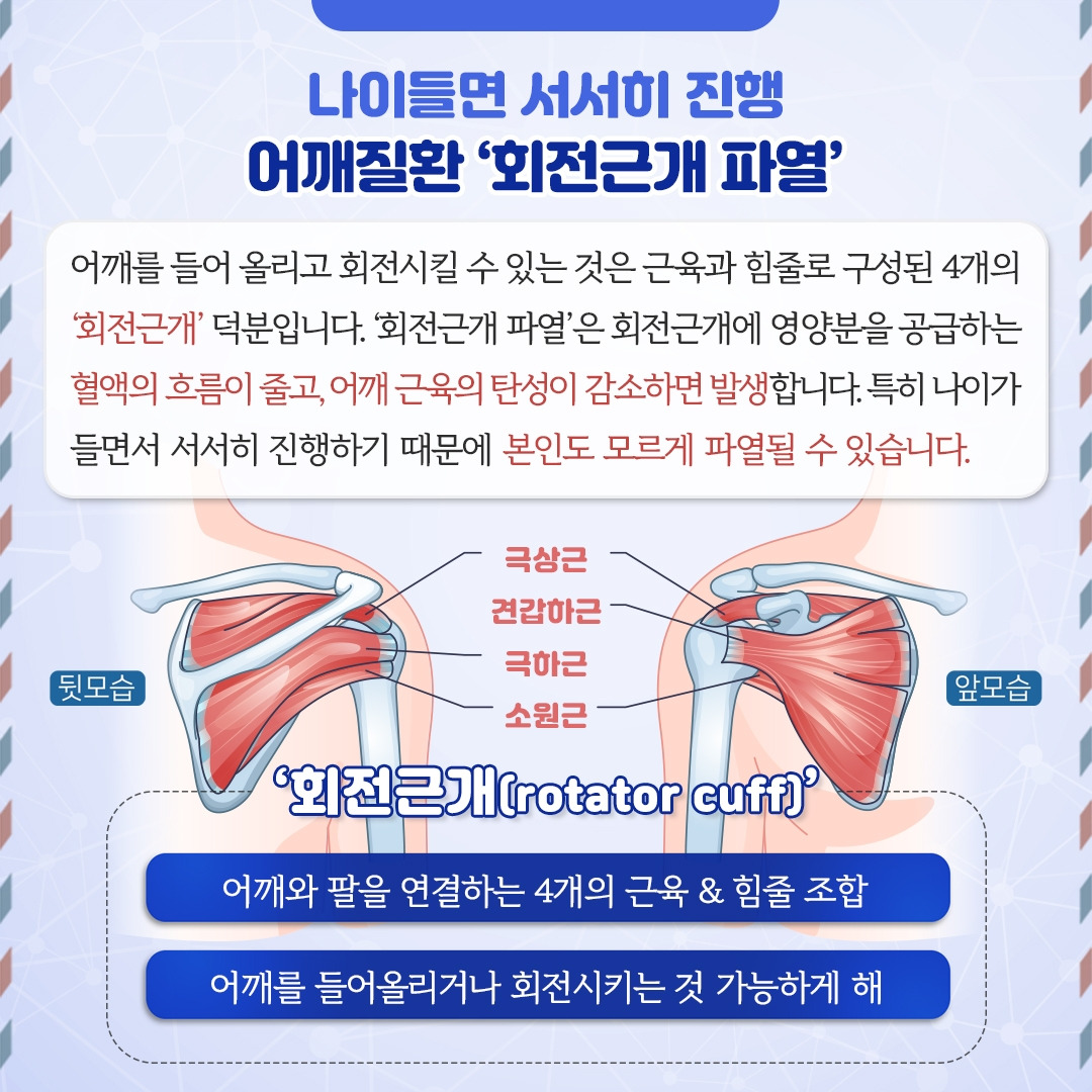 회전근개파열_02.jpg
