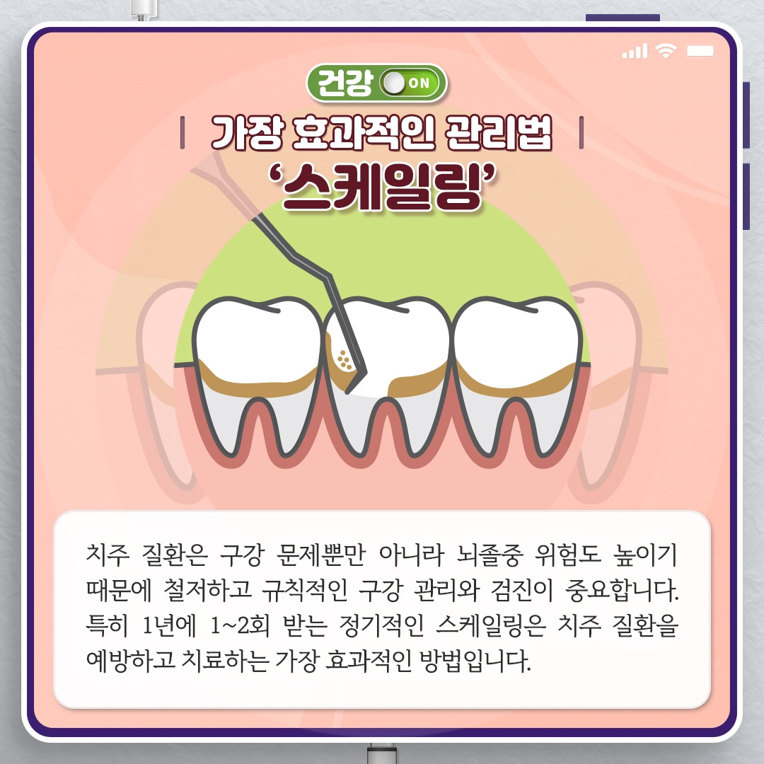 치주질환뇌졸중_06.jpg