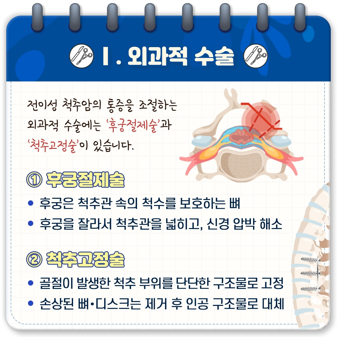 전이성척추암_05.jpg