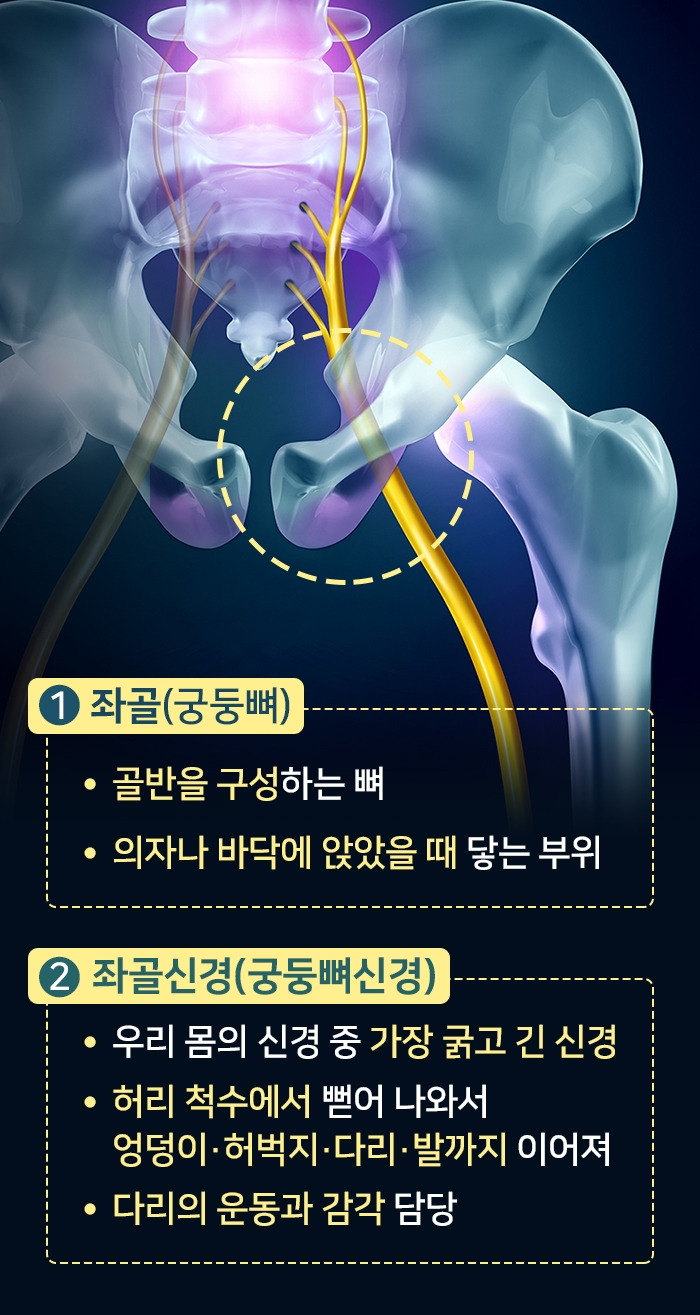 좌골신경통_05.jpg