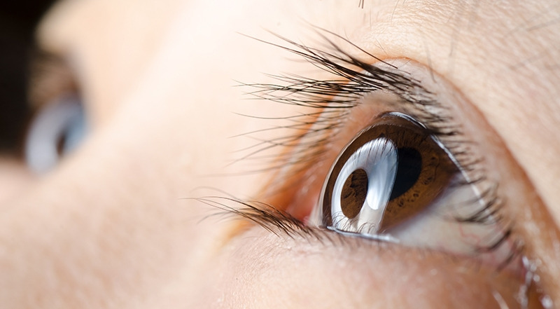 5.▶누낭염‧봉와직염 주의해야.jpg