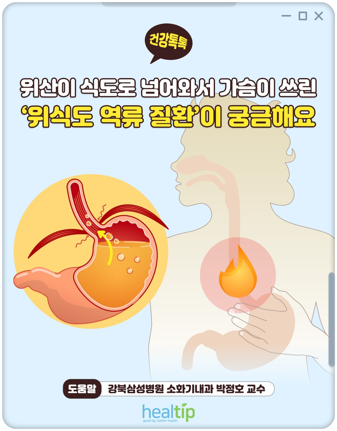 위식도역류_01_힐팁.jpg