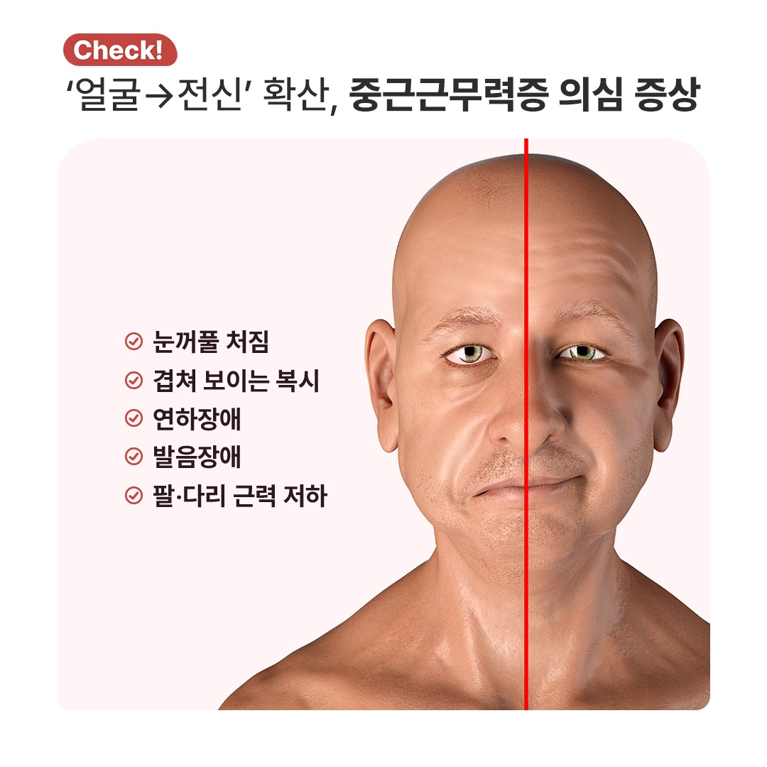 중증근무력증_06.jpg