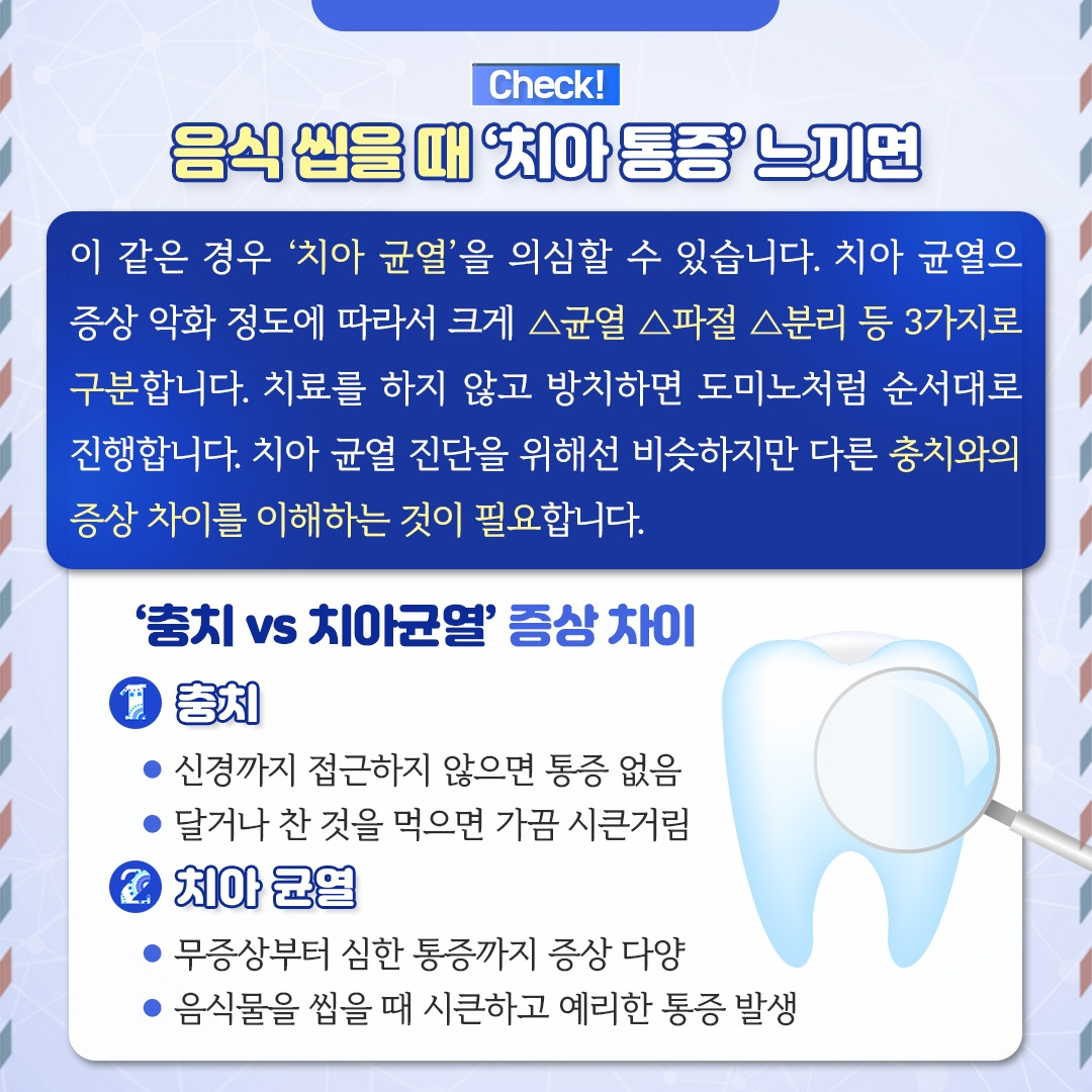 치아 균열_04.jpg