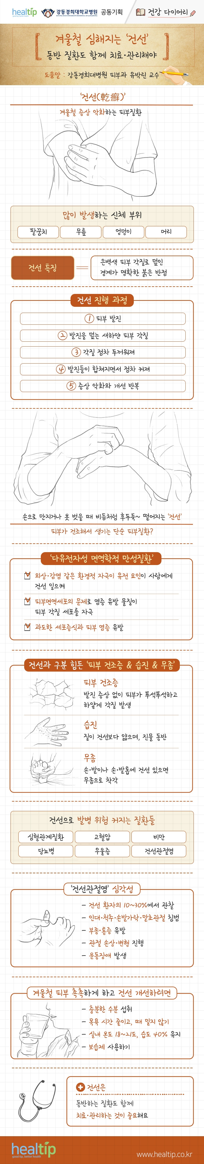 겨울철 심해지는 ‘건선’ 동반 질환도 함께 치료‧관리해야 _200128.jpg