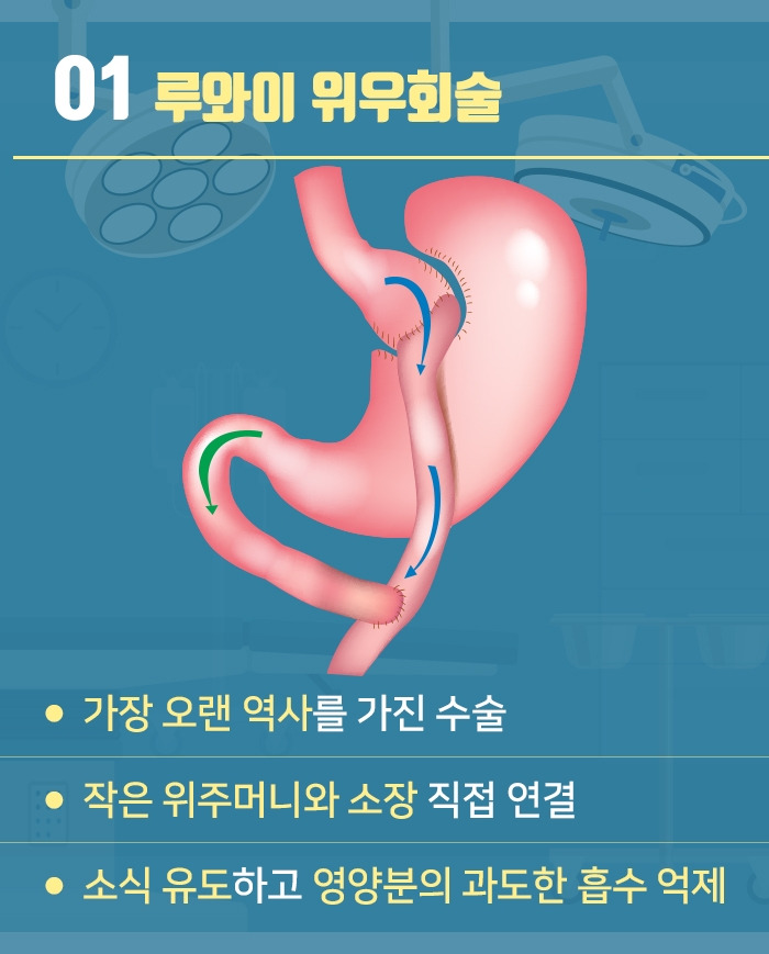 대사비만수술_04.jpg