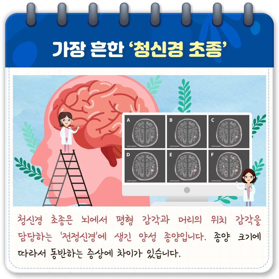 청신경초종 수두증_03.jpg