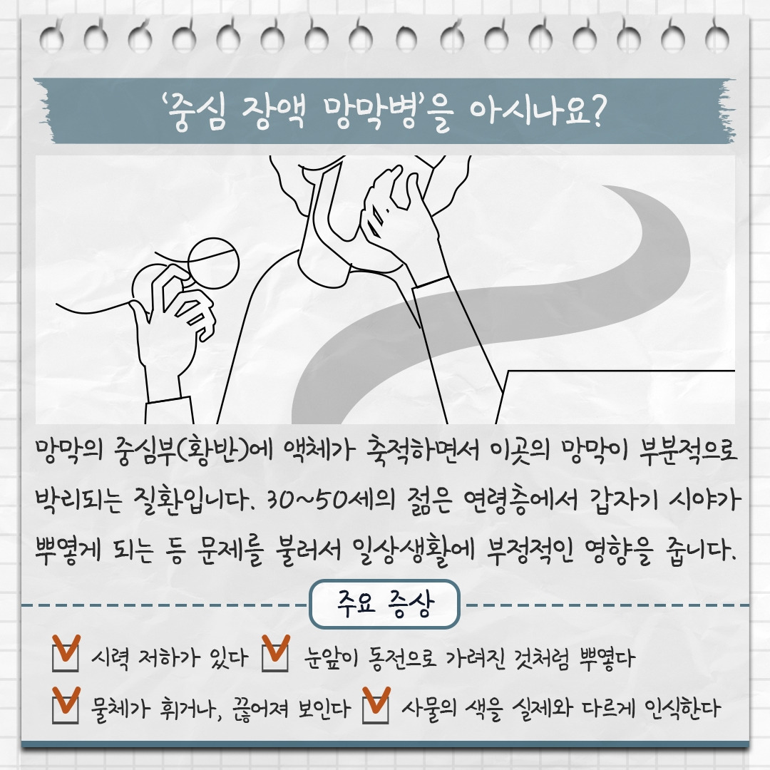 중심 장액 망막병 1 .jpg