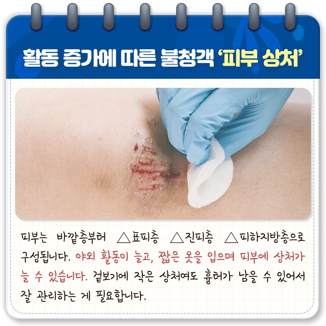 피부 상처 치료_02.jpg