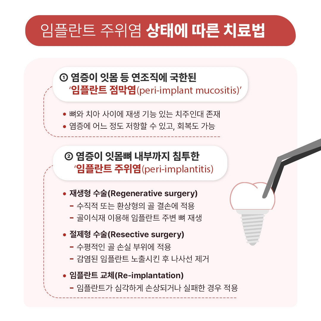 임플란트주위염_06.jpg