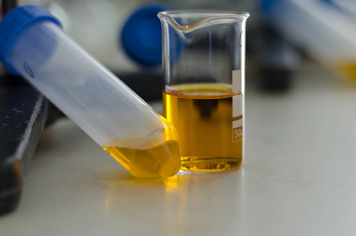 ▶단백뇨까지 겹치면 임신중독증으로 악화.jpg