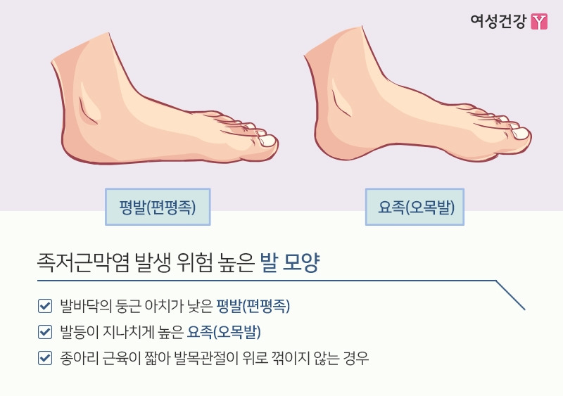 3.※족저근막염 발생 위험 높은 발 모양.jpg