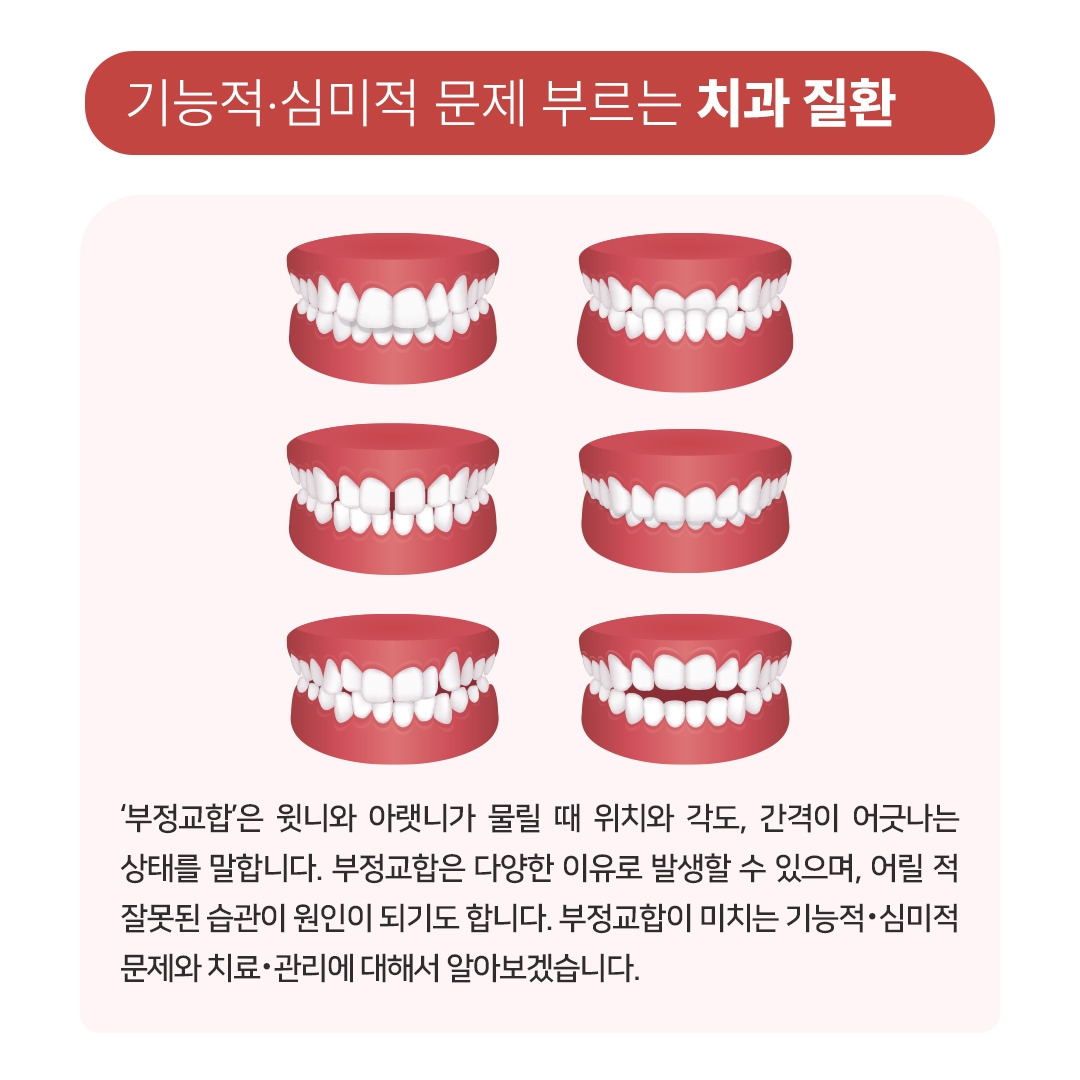 부정교합_02.jpg