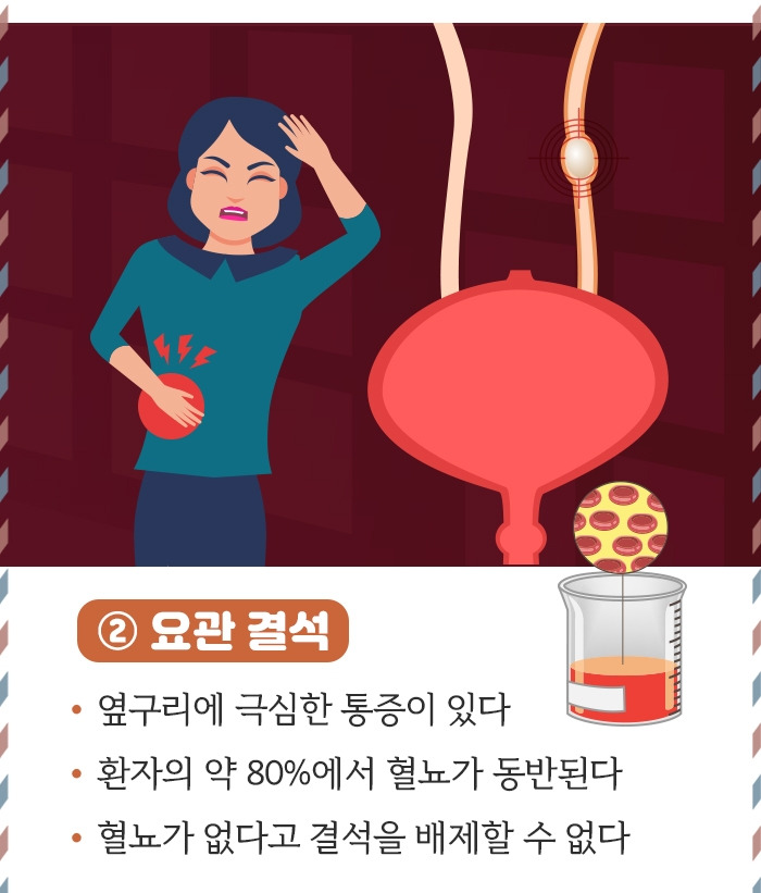 요로결석_05.jpg