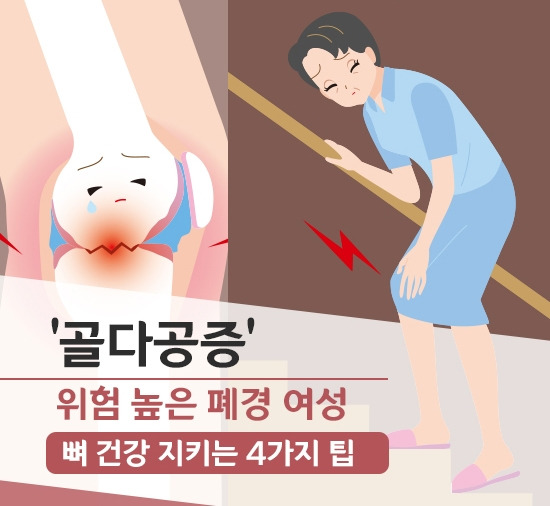 강동경희대병원278-골다공증 폐경.jpg