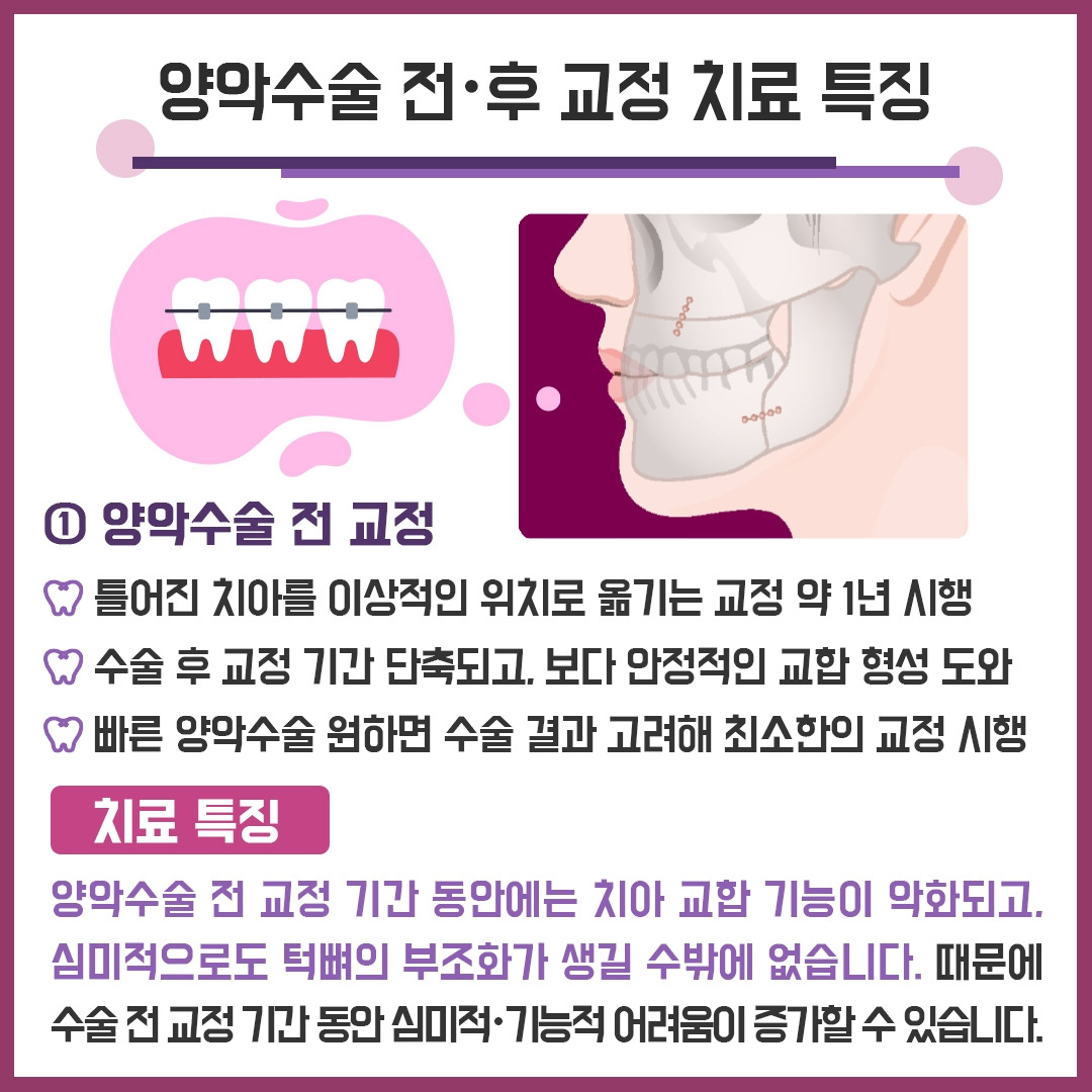 양악수술_05.jpg