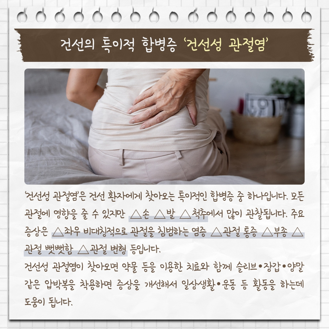 건선성 관절염_03 .jpg