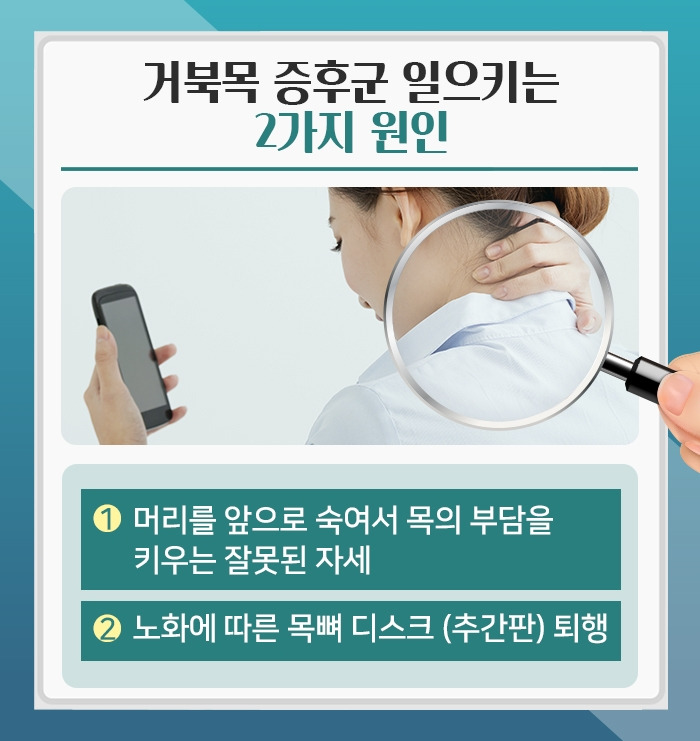 거북목 증후군_4.jpg