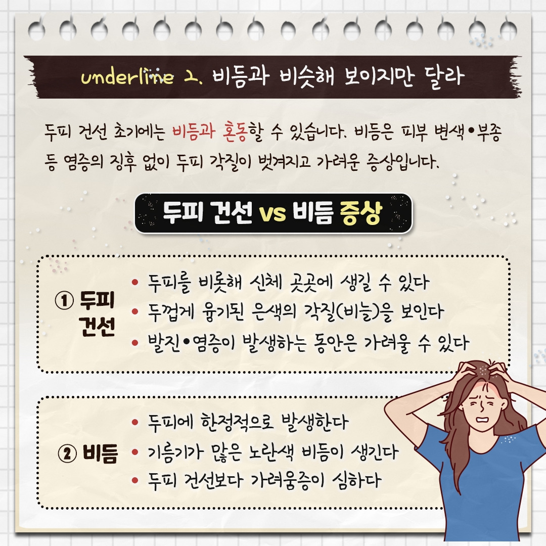두피 건선__04.jpg
