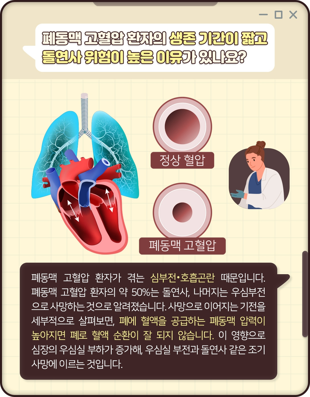 폐동맥 고혈압_04.jpg