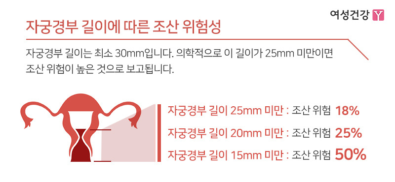 ※자궁경부 길이에 따른 조산 위험성.jpg