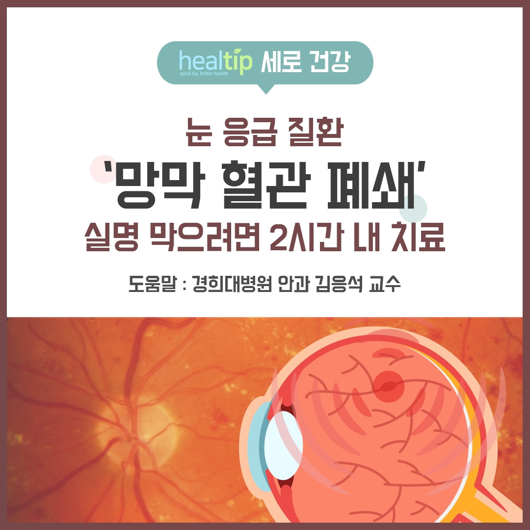망막혈관폐쇄_01_힐팁.jpg