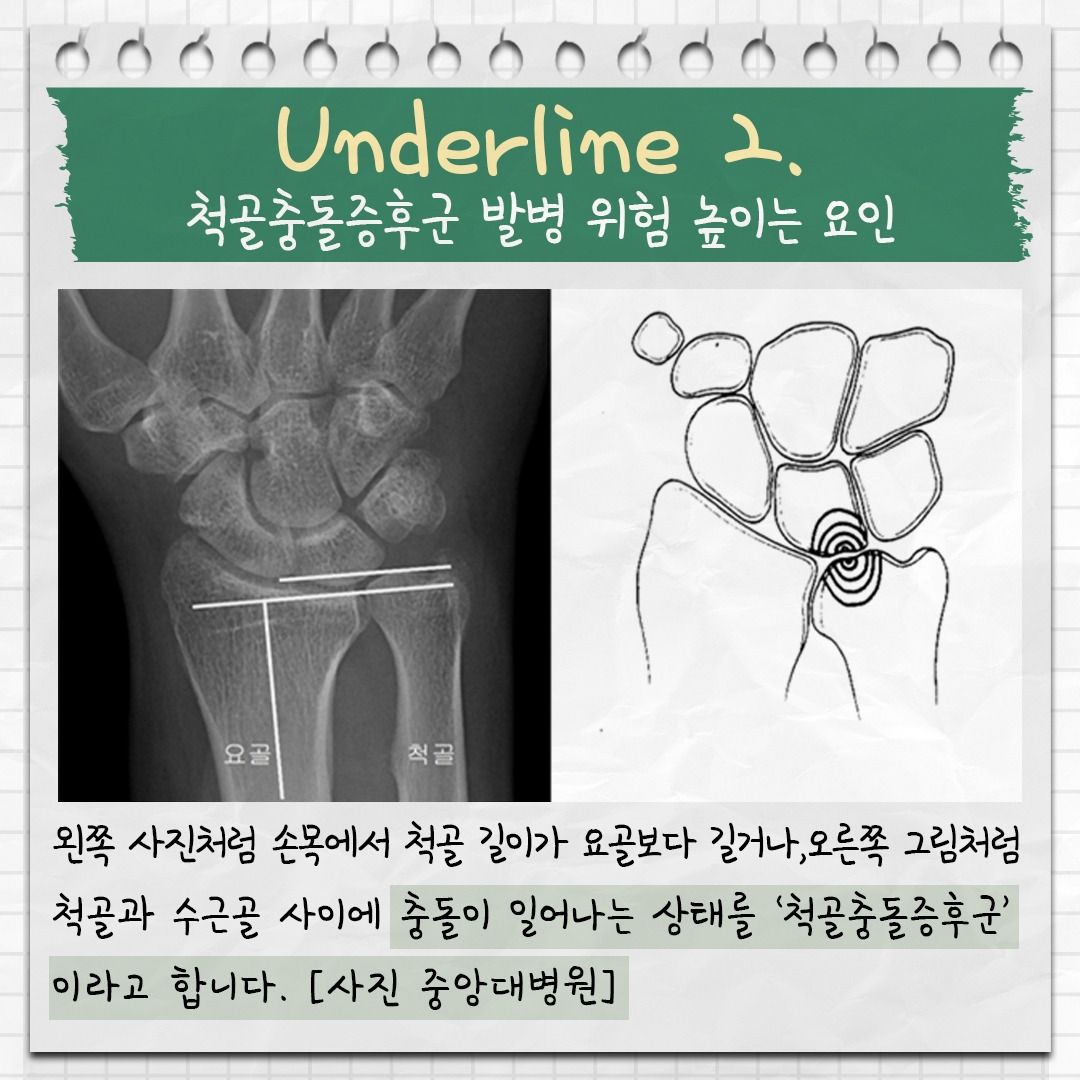 척골충돌증후군 4.jpg