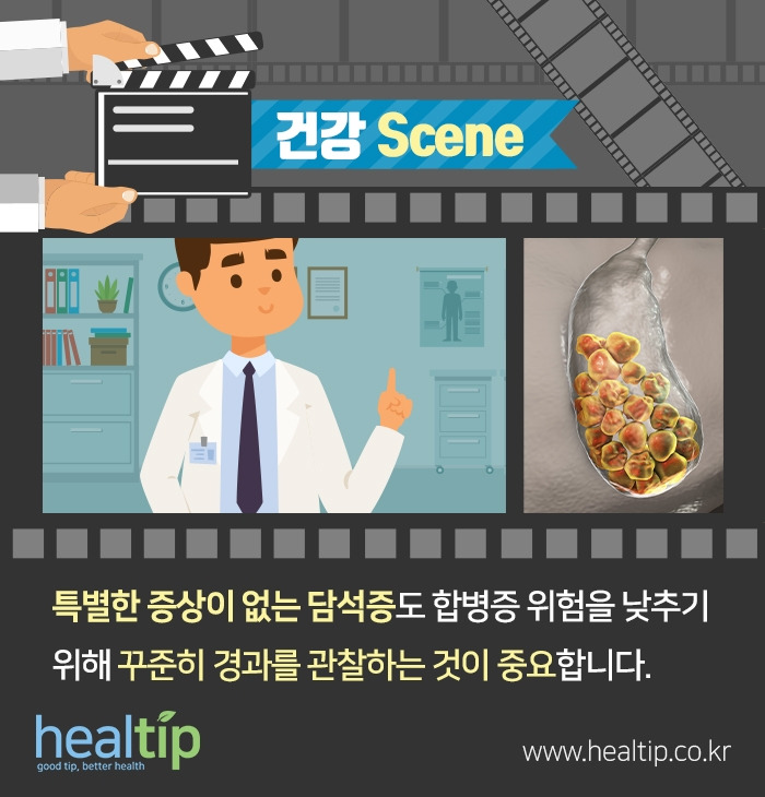 담석증_6.jpg