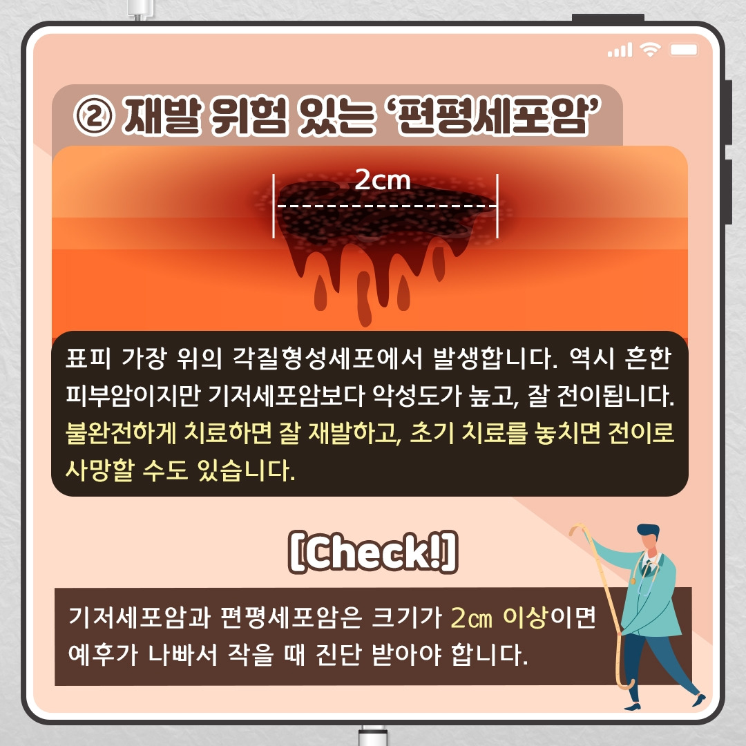 피부암_06 .jpg