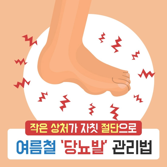 강동경희대병원252-여름철 당뇨발1.jpg