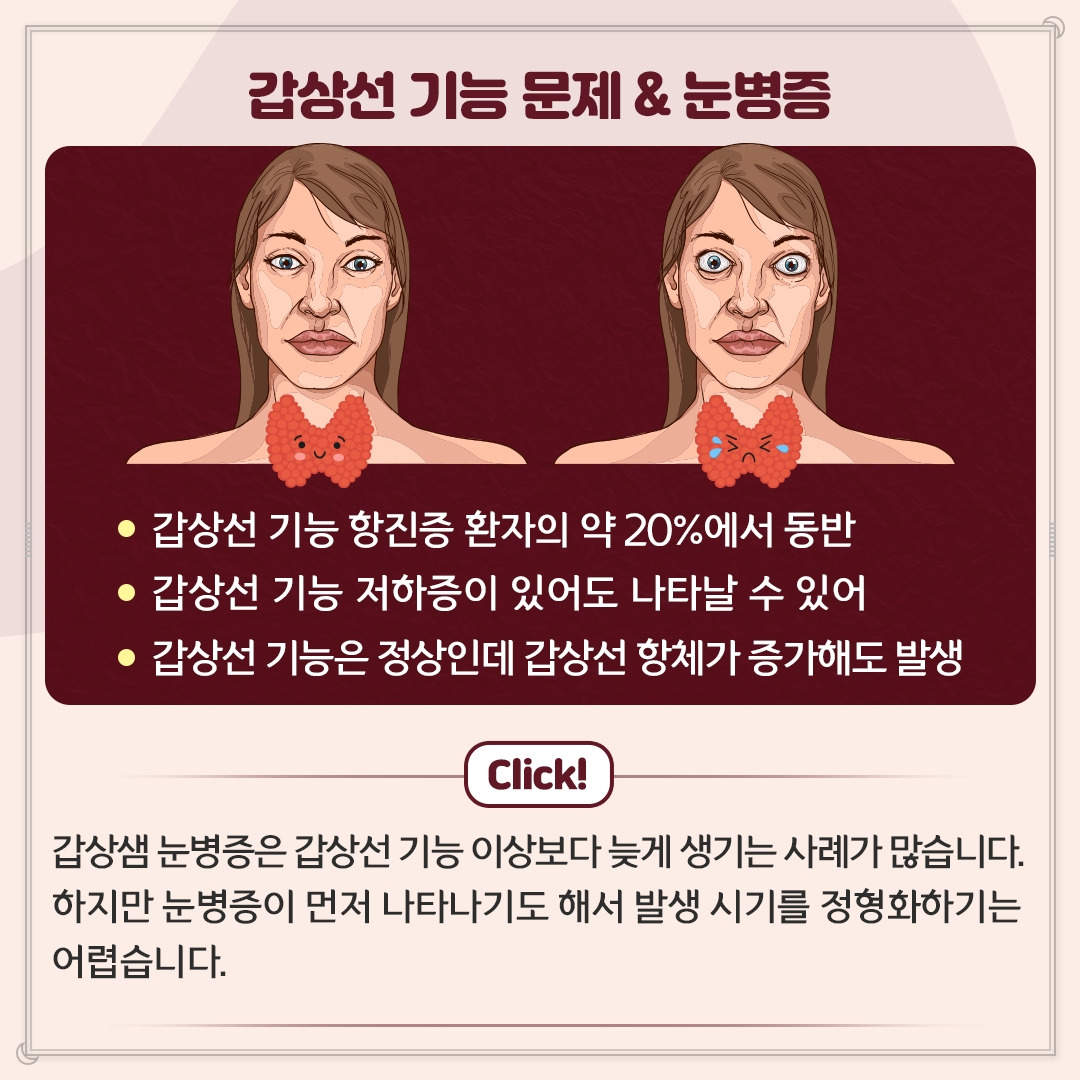 갑상샘 눈병증_04.jpg