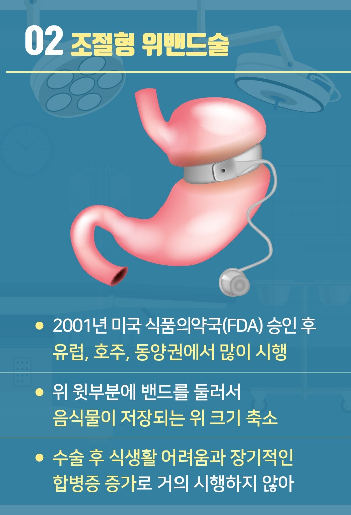 대사비만수술_05.jpg