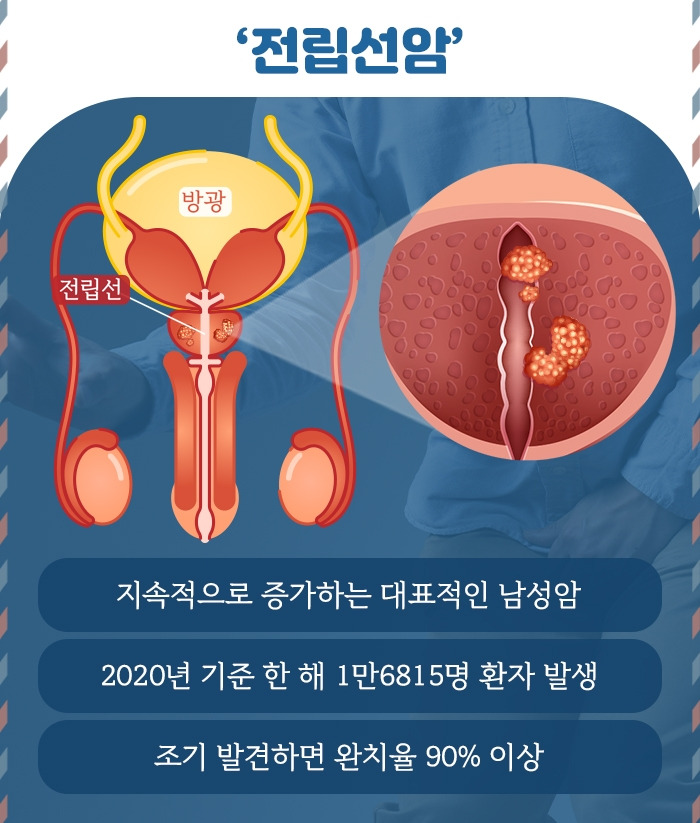 전립선암_2.jpg