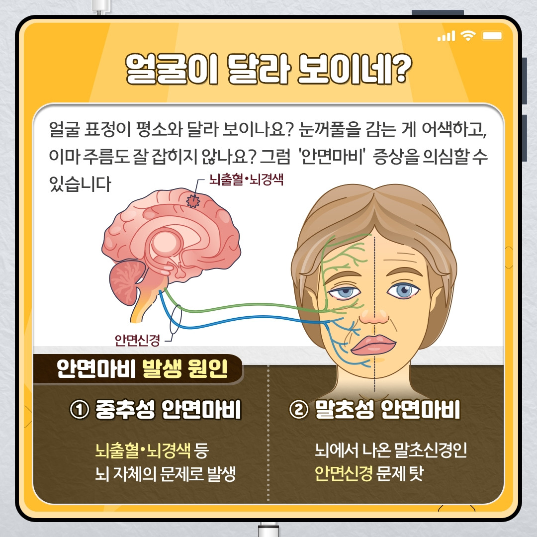 안면마비_02.jpg