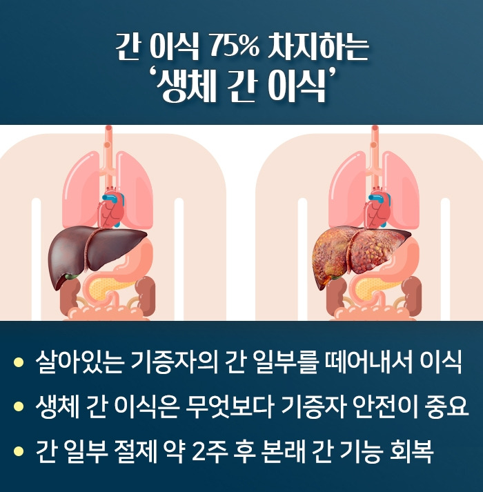 간이식_05.jpg