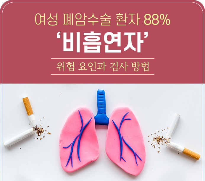 강동경희대병원335-비흡연 예성 폐암.jpg