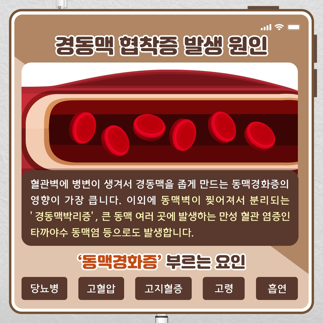 경동맥 협착증_07.jpg